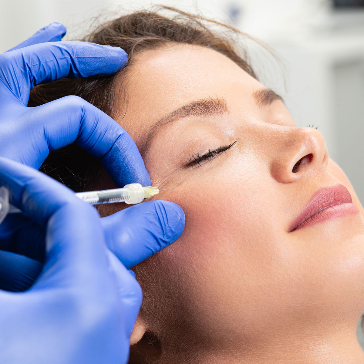 Botox Treatment London